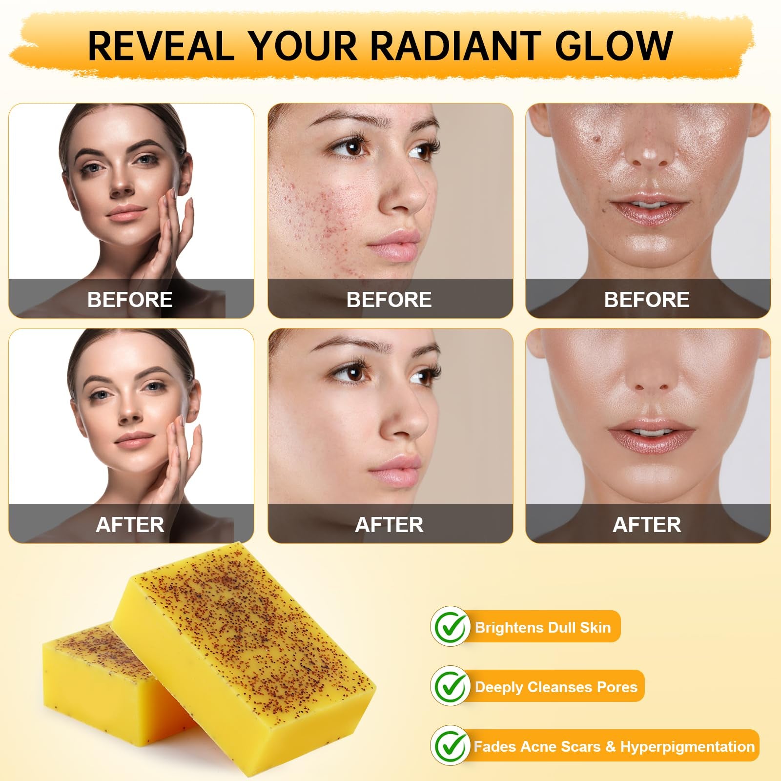 [ Free shopping ] 1/3Pcs Lemon & Turmeric Soap Bar for Dark Spots, Powered by Kojic Acid & Vitamin C for Face/Body