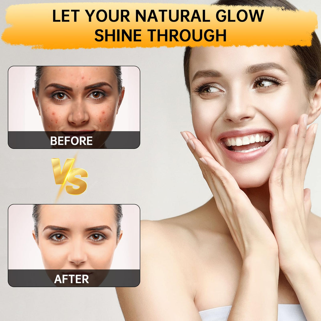 [ Free shopping ] 1/3Pcs Lemon & Turmeric Soap Bar for Dark Spots, Powered by Kojic Acid & Vitamin C for Face/Body